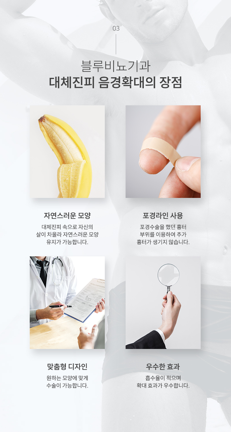 남성수술 이미지4